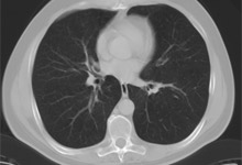 ct_thorax.jpg