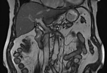 mrt_abdomen.jpg
