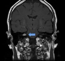 neuro_akn.jpg