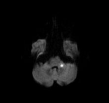 neuro_schlaganfall_klein.jpg